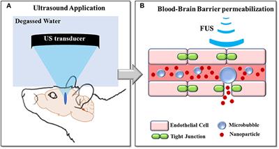 Magnetic Resonance Methods for Focused Ultrasound-Induced Blood-Brain Barrier Opening